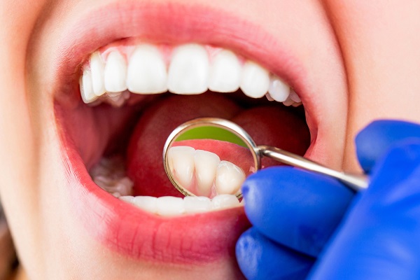 Dental Cleaning Lake Forest, CA
