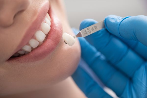 Is Dental Crown Replacement Common?