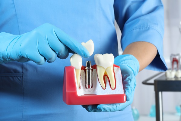 How Is A Dental Implant Placed?