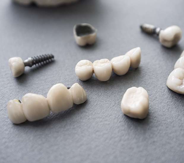 Lake Forest The Difference Between Dental Implants and Mini Dental Implants