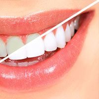Dental Bonding Treatment: A Good Option for Sensitive Teeth - Stunning  Smiles of Lake Forest Lake Forest California