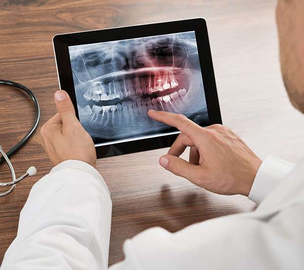 Lake Forest Types of Dental Root Fractures
