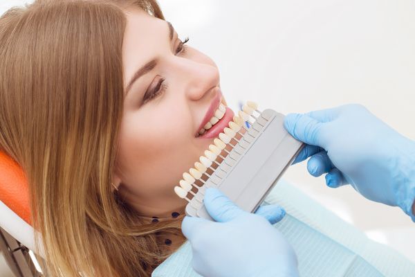 Dental Veneers Can Help A Gummy Smile